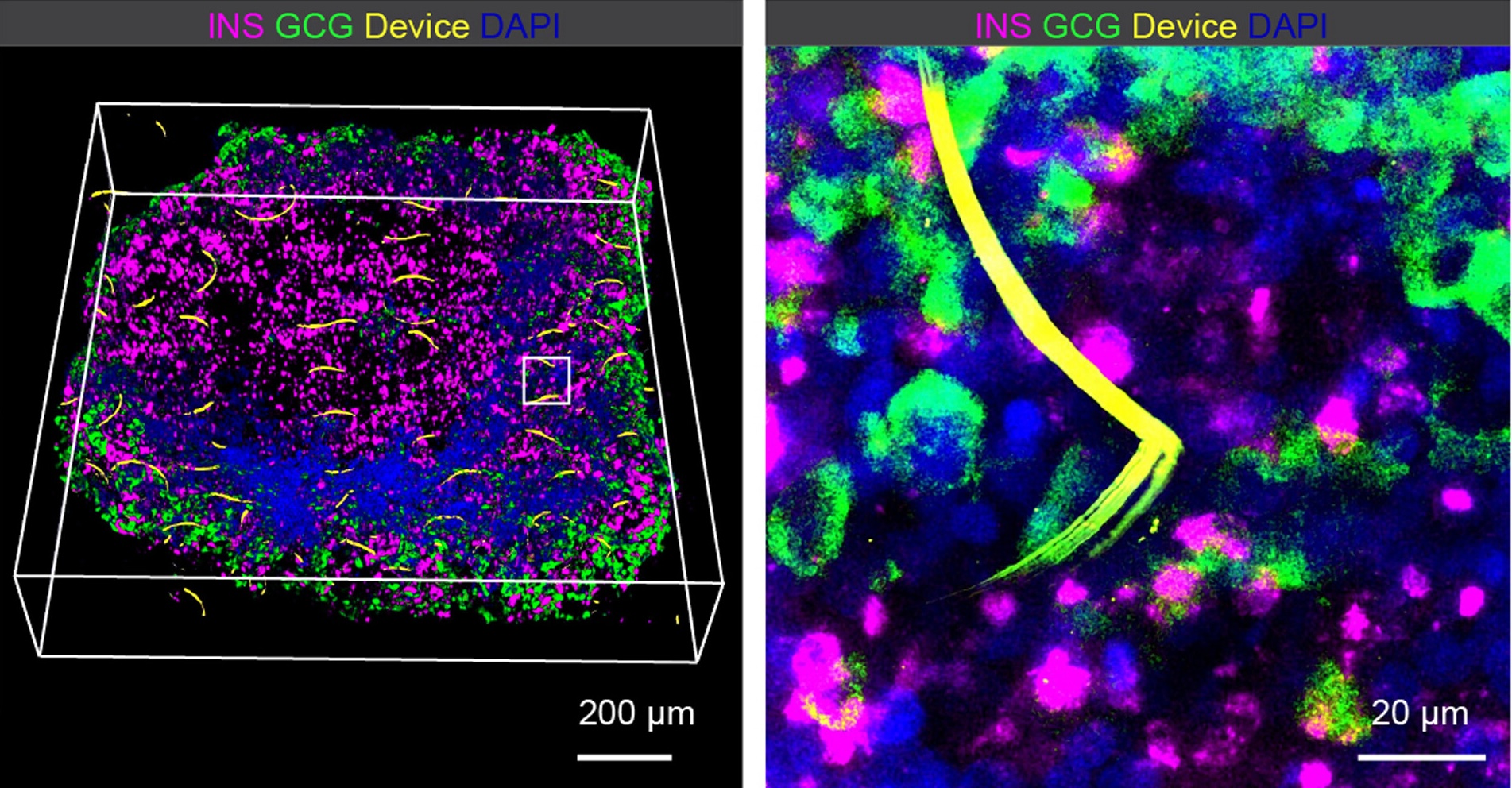 Fluorescence microscopy images of a pancreatic organoid with embedded electronics