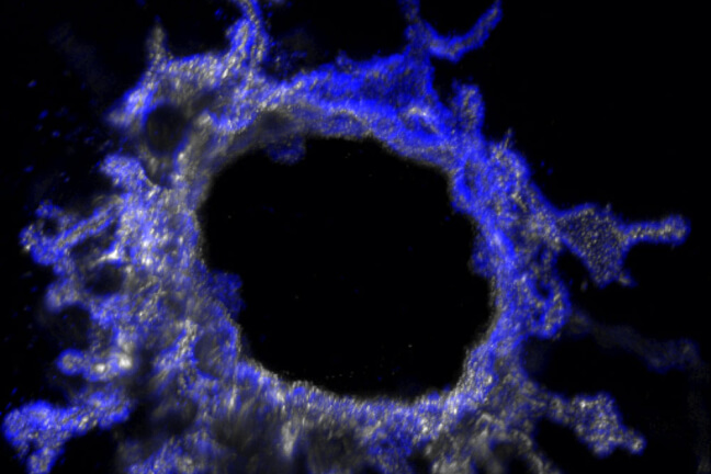 ureteric bud tubule-on-chip with central perfusable channel