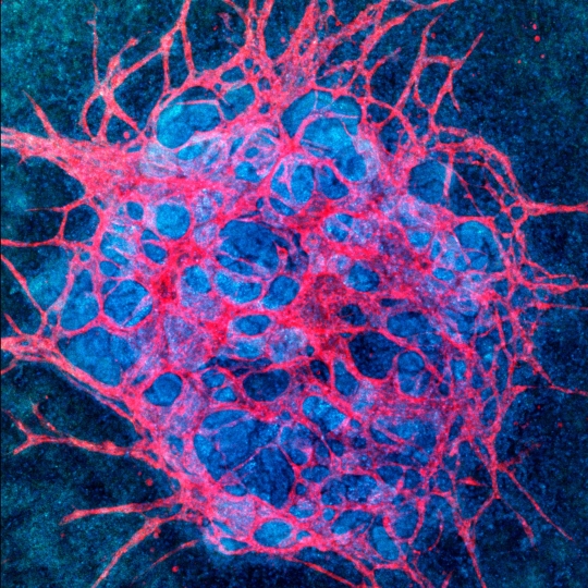 image of a Vascularized kidney organoid