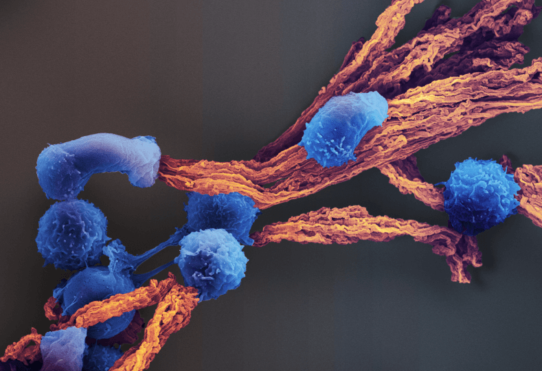 A microscopic view of several fuzzy looking blue blobs covering fibrous orange strings (the "scaffold").