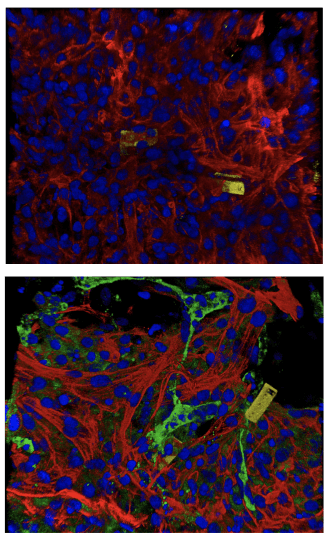 Two microscopic views showing the nanoelectonics in yellow and blue interspersed with red and green tissue cells.