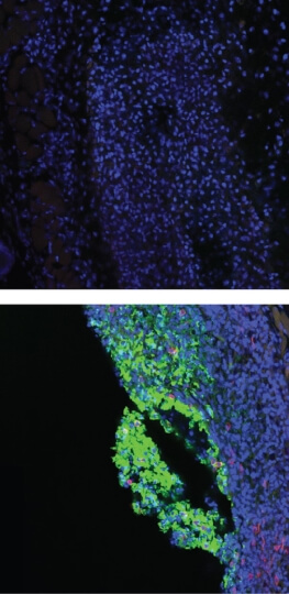 Two images of blue T-cell enhancing scaffolds, with portions of one stained green to show the increased number of CAR-T cells