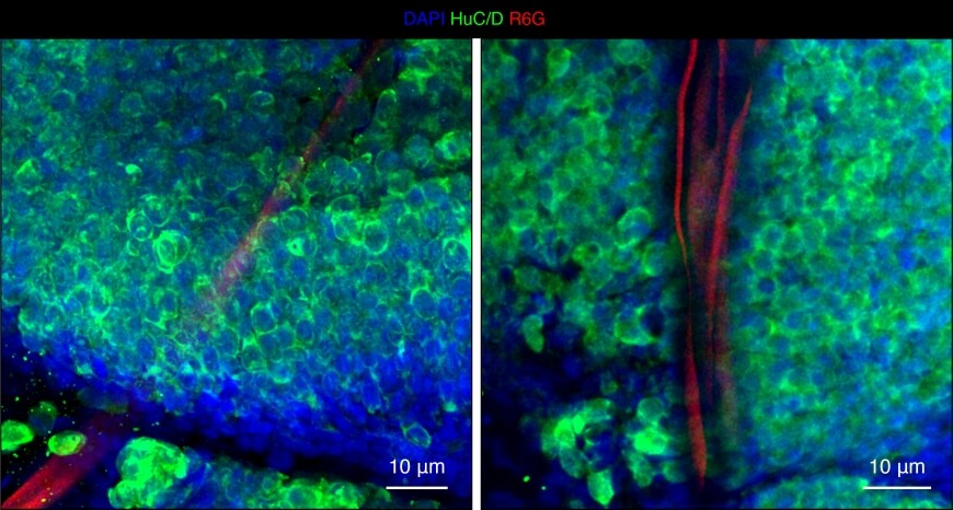 immunostained image that shows the electronic device in red implanted in the tadpole brain
