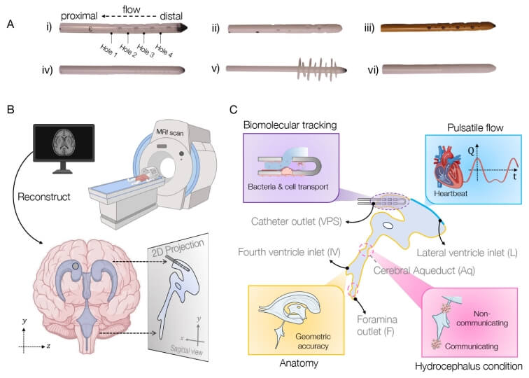 Schematic of approach to simulating brain- ­ shunt fluid dynamics
