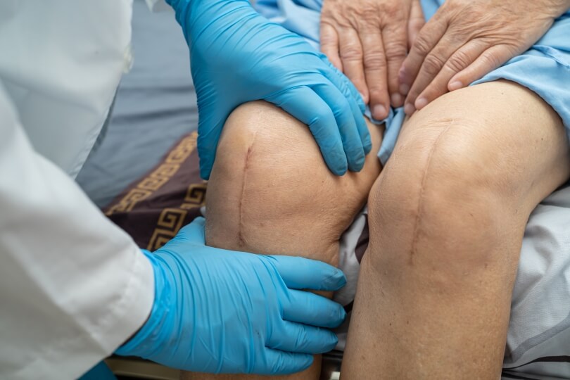 knees of a patient being checked by a doctor