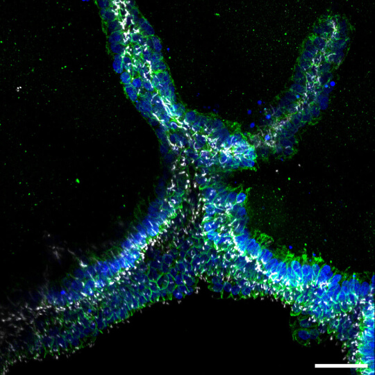 ureteric bud tubules