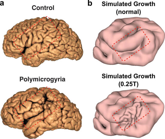 comparison between human brain MRI reconstructions and ferret brains