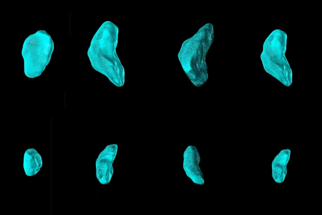 a series of blue-tinted lymph nodes