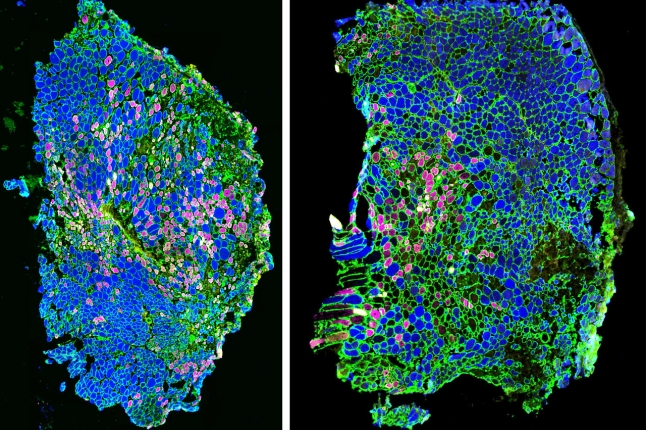 Immunofluorescence images show that when an injured muscle is treated with mechanotherapy (right), its muscle fiber type composition changes compared to untreated muscles (left). 