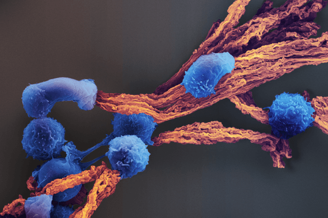 A microscopic view of several fuzzy looking blue blobs covering fibrous orange strings (the "scaffold").