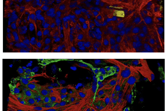 Two microscopic views showing the nanoelectonics in yellow and blue interspersed with red and green tissue cells.