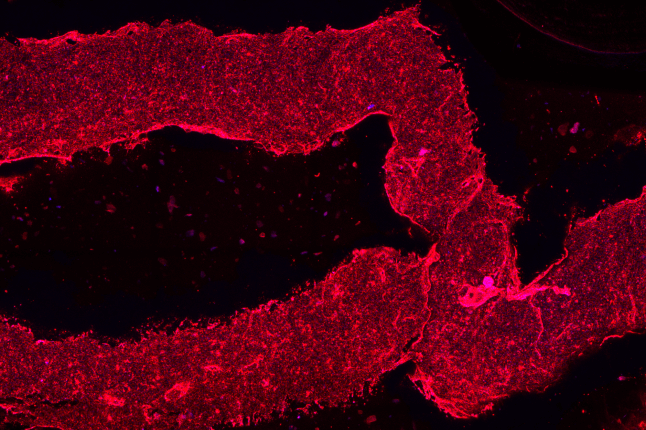 3D-printed blood vessels