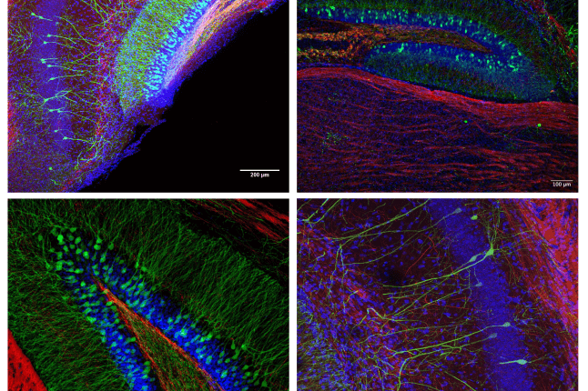 images of mouse brain sections