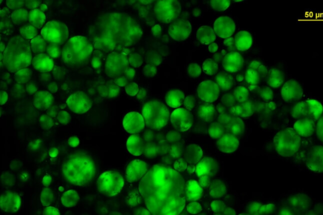 A microscopic image of the ObaCell® Obesity-on-a-Chip with large lipid droplets (in green) that aid in mimicking adipose tissue in obese patients.