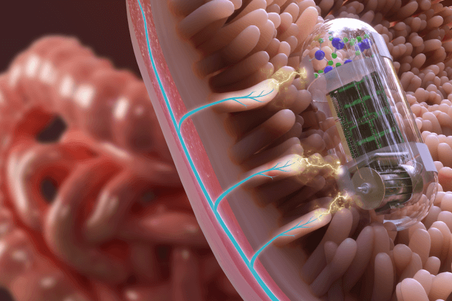 image of pill in the GI track