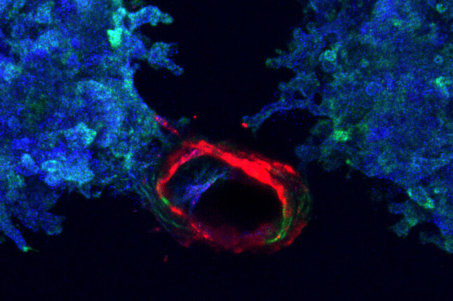 Printed ureteric tubule networks embedded in matrix