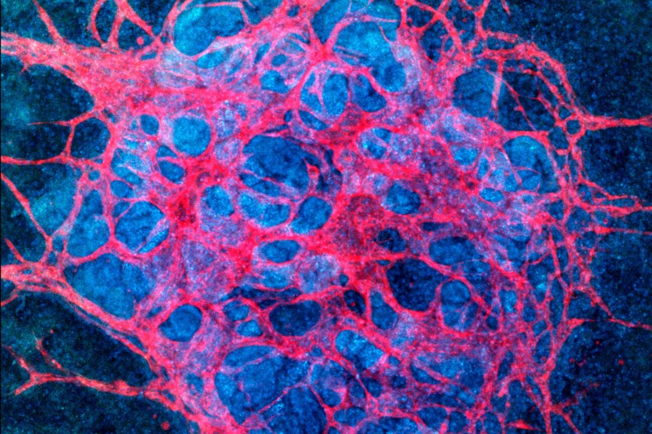 Gut coils with help from its elastic neighbor