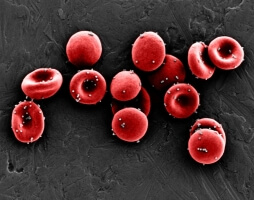 image of red blood cells