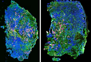Immunofluorescence images show that when an injured muscle is treated with mechanotherapy (right), its muscle fiber type composition changes compared to untreated muscles (left).