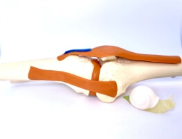 Janus Tough Adhesives on a Knee