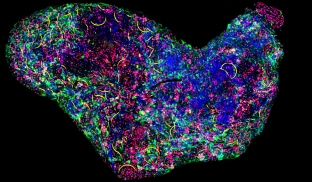 image of Cyborg brain organoids
