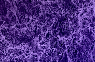 image of an ECM-mimicking hydrogel