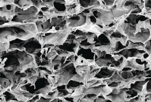 An image of the cell-permeable porous structure of an injectable SIVET immuno-material