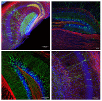 images of mouse brain sections