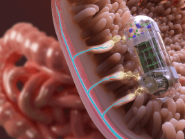 image of pill in the GI track