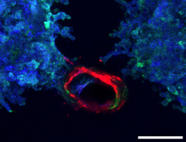 Printed ureteric tubule networks embedded in matrix